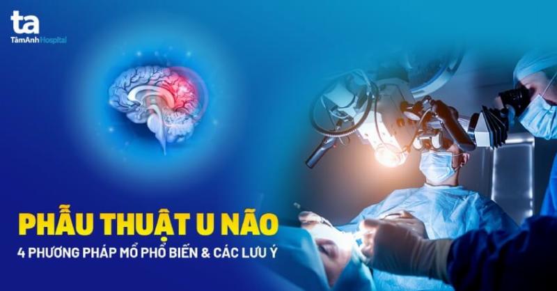 Y ta hoac bac si dang lang nghe chu dong benh nhan chia se tam tu